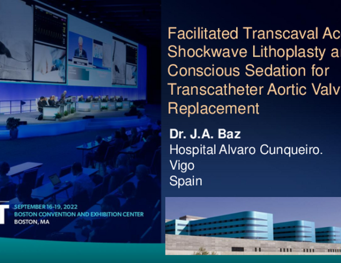 TCT 626: Facilitated Transcaval Access by Shockwave Lithoplasty and Conscious Sedation for Transcatheter Aortic Valve Replacement