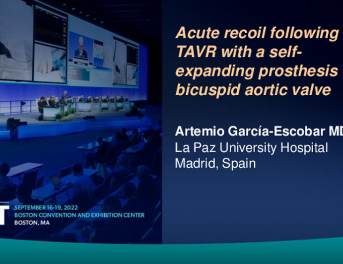 TCT 816: Acute recoil following transcatheter aortic valve replacement with a self-expanding prosthesis in bicuspid aortic valve. 