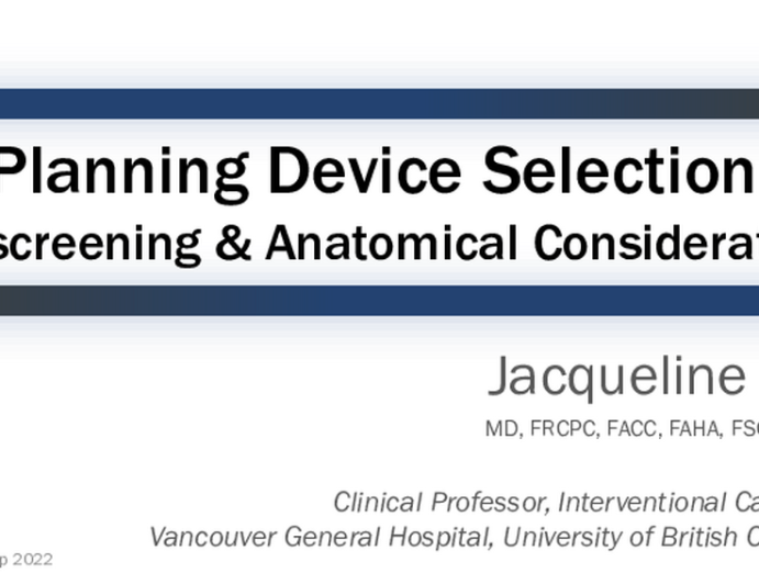 Planning Device Selection