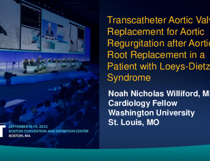 TCT 747: Transcatheter Aortic Valve Replacement for Aortic Regurgitation after Aortic Root Replacement in a Patient with Loeys-Dietz Syndrome