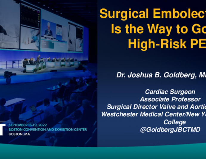 Surgical Embolectomy Is the Way to Go in High-Risk PE