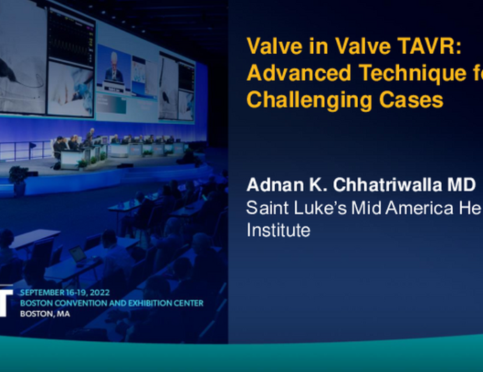 Valve-in-Valve TAVR:  Advanced Technique for Challenging Cases