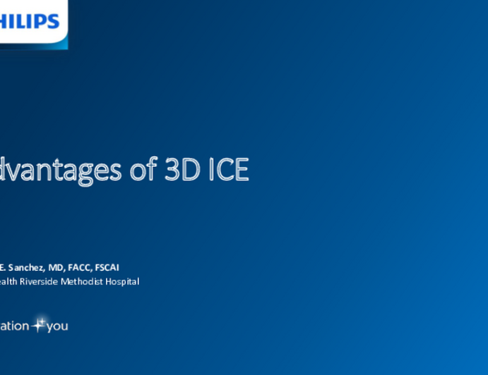The advantages of 3D ICE guidance