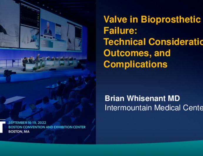 Valve in Bioprosthetic Mitral Failure:  Technical Considerations, Outcomes, and Complications