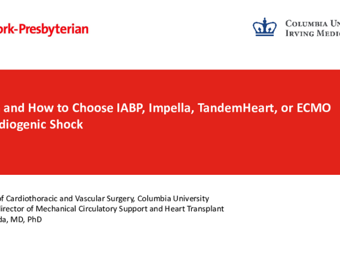 When and How to Choose IABP, Impella, TandemHeart, or ECMO in CS