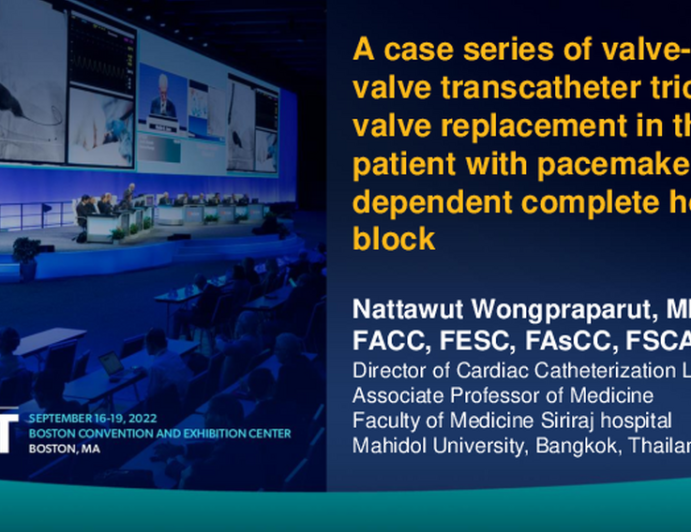 TCT 620: Valve-in-valve transcatheter tricuspid valve replacement in the patient with pacemaker-dependent complete heart block