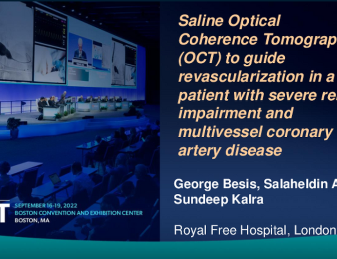 TCT 736: Saline Optical Coherence Tomography (OCT) to guide revascularizationin in a  patient with severe renal impairment and multivessel coronary artery disease.