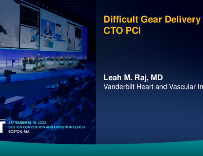 Difficult Gear Delivery in CTO PCI
