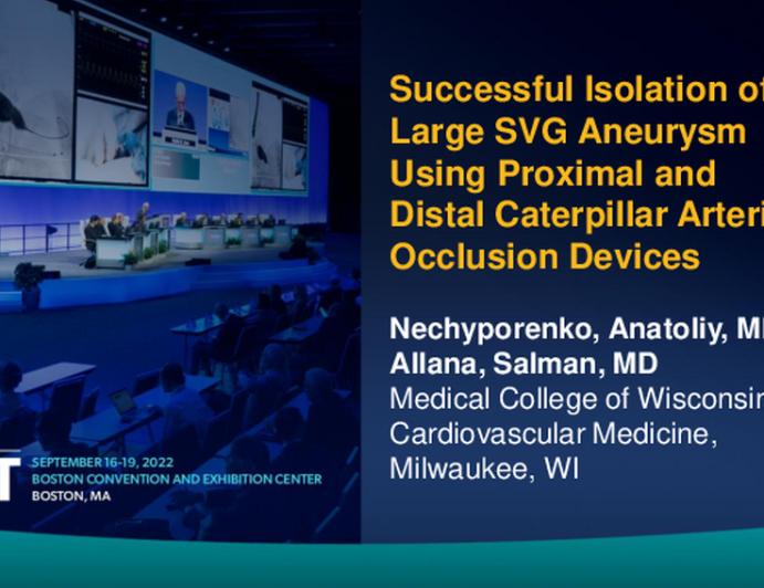 TCT 797: Successful Isolation of Large Saphenous Vein Graft Aneurysm Using Proximal and Distal Caterpillar Arterial Occlusion Devices 