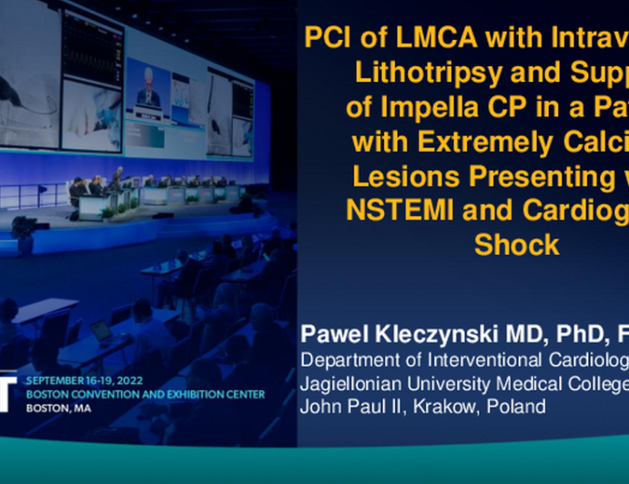 TCT 826: PCI of LMCA With Intravascular Lithotripsy and Support of Impella CP in Patient With Extremely Calcified Lesions Presenting With NSTEMI and Cardiogenic Shock.