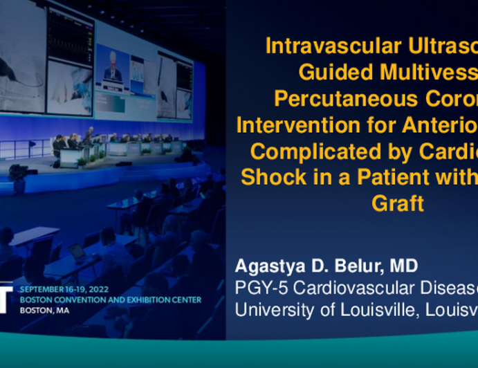 TCT 632: Intravascular Ultrasound-Guided Multivessel Percutaneous Coronary Intervention for Anterior STEMI Complicated by Cardiogenic Shock in a Patient With Cabrol Graft 