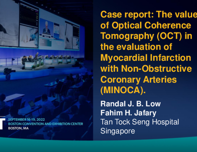 TCT 790: Case report: The value of optical coherence tomography (OCT) in the evaluation of myocardial infarction with non-obstructive coronary arteries (MINOCA).
