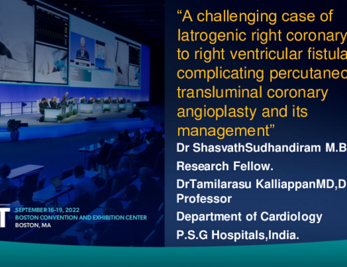 TCT 653: A Challenging Case of Latrogenic Right Coronary Artery-to-Right Ventricular Fistula Complicating Percutaneous Transluminal Coronary Angioplasty and Its Management