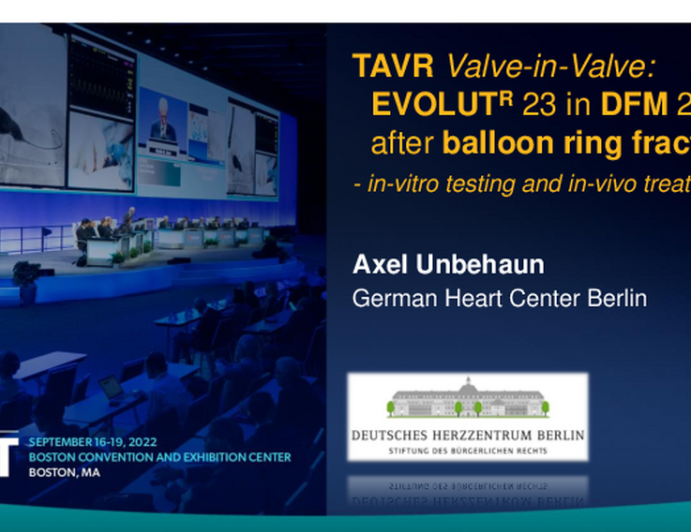 TCT 708: Balloon ring fracture and transcatheter aortic valve-in-valve implantation into a failed Direct Flow Medical prosthesis: in-vitro benchmark tests and in-vivo treatment