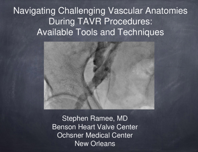 Keynote Lecture: Navigating Challenging Vascular Anatomies During TAVR Procedures: Available Tools and Techniques