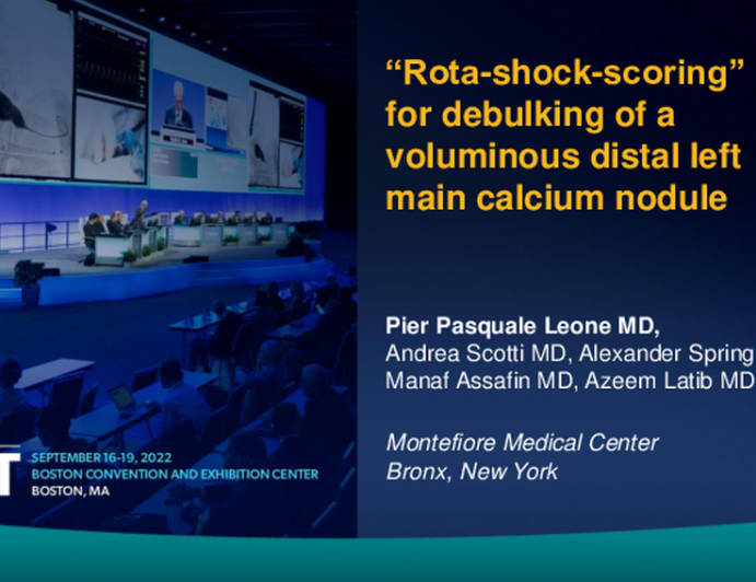 TCT 725: "Rota-shock-scoring" for debulking of a voluminous distal left main calcium nodule