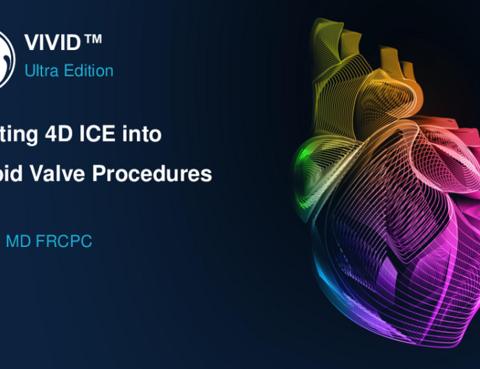 Integrating 4D ICE into Tricuspid Procedures