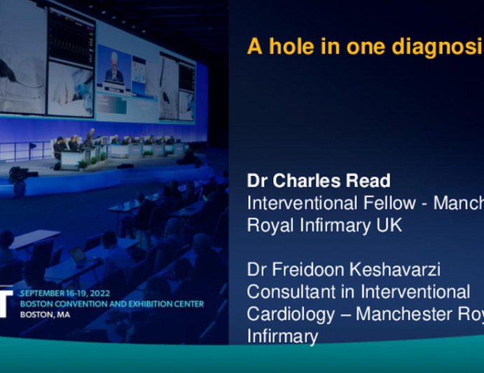 TCT 698: A multi modality approach to investigating and treating concomittant non-ST segment elevation myocardial infarction and pulmonary embolism in Erdheim Chester Disease - an extremely rare haematological neoplastic histicytosis