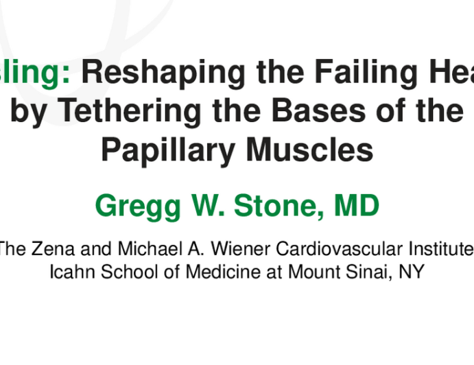 Reshaping the Failing Heart by Tethering the Bases of the Papillary Muscles