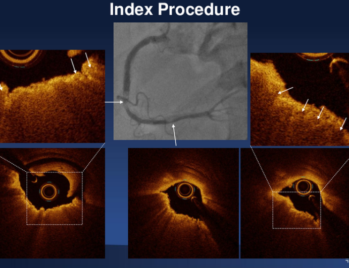 Case Procedure Decision-Making and Final Outcome