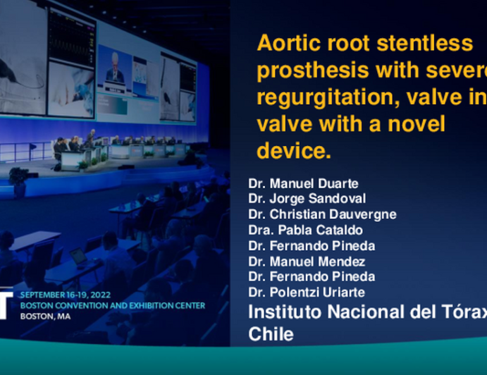 TCT 679: Aortic root stenless prosthesis with severe regurgitation, valve in valve with a novel device.