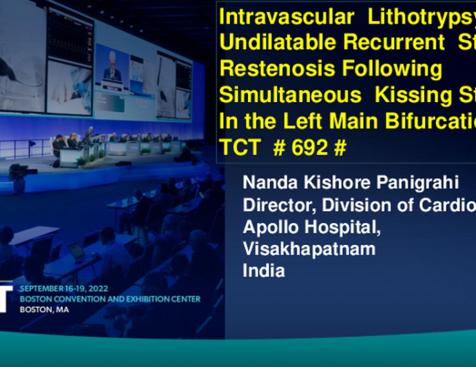 TCT 692: Intravascular Lithotrypsy  For  Undilatable  Recurrent  Stent Restenosis Following Simultaneous  Kissing Stent In  Left Main Bifurcation.