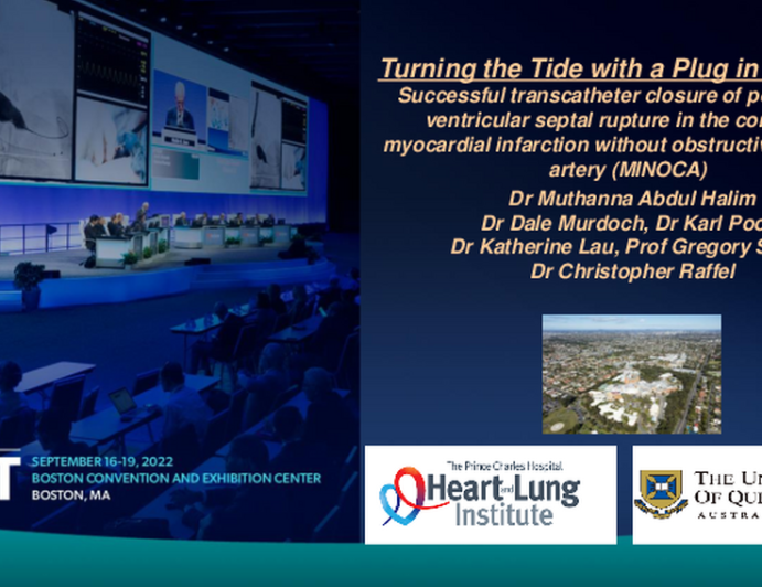 TCT 618: Turning the Tide with a Plug in the Hole: Successful transcatheter closure of post-infarct ventricular septal rupture in the context of myocardial infarction without obstructive coronary artery (MINOCA)