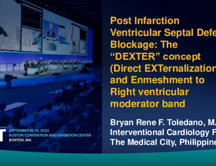 TCT 748: Post Infarction Ventricular Septal Defect Blockage: The "DEXTER" concept (Direct EXTernalization and Emneshment to Right ventricular moderator band)