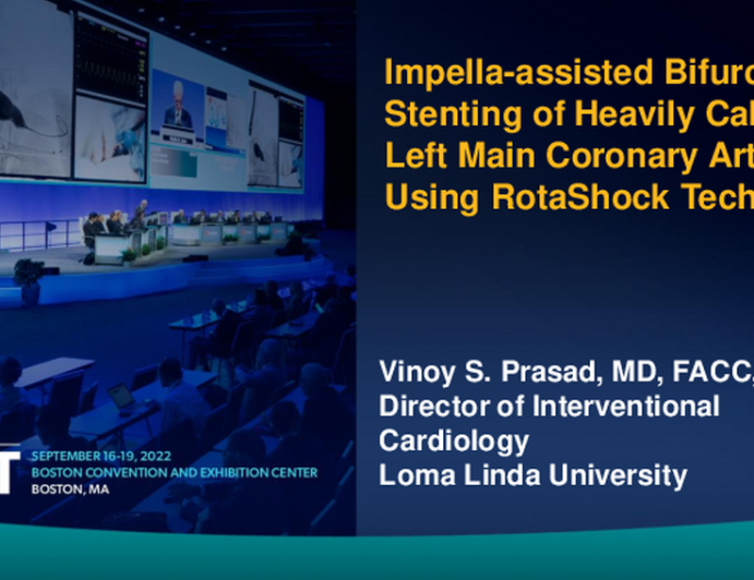 TCT 750: Impella-assisted Bifurcation Stenting of Heavily Calcified Left Main Coronary Artery Using RotaShock Technique.