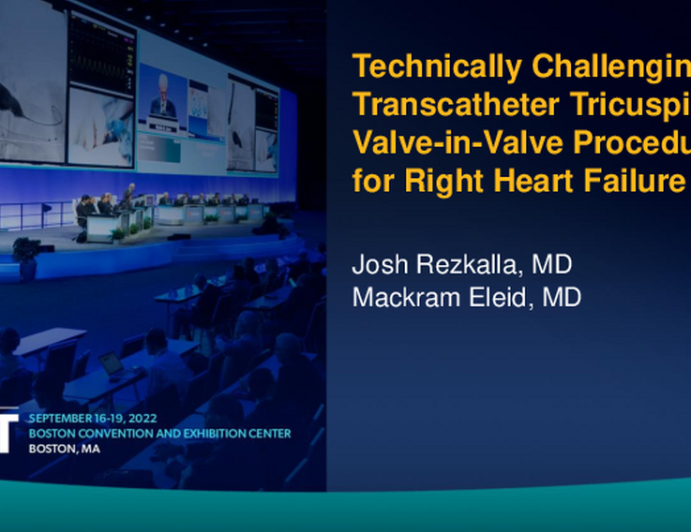 TCT 639: Technically Challenging Transcatheter Tricuspid Valve in Valve Procedure for Right Heart Failure