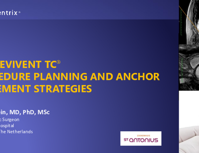 Revivent TC® Procedure Planning and Anchor Placement Strategies