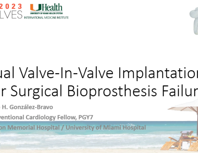Dual Valve-In-Valve Implantation For Surgical Bioprosthesis Failure