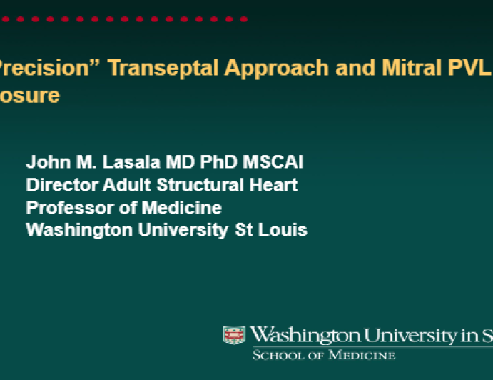 “Precision” Transeptal Approach and Mitral PVL Closure