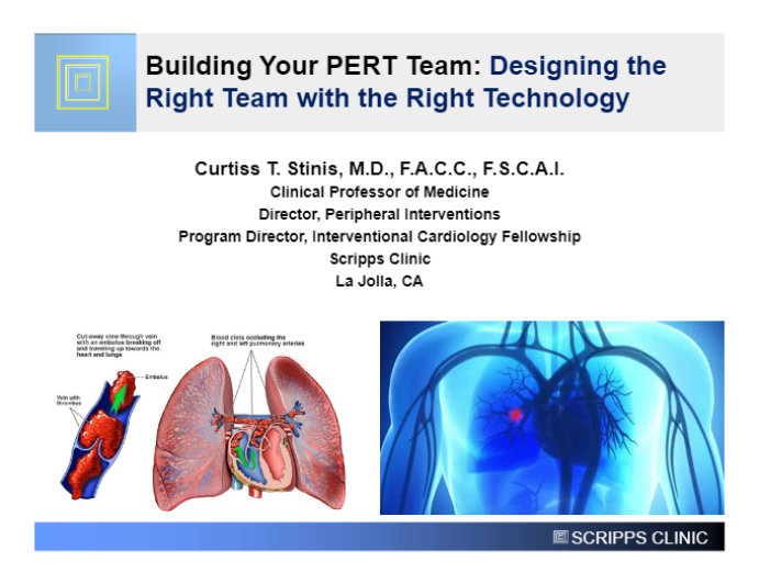 Building Your PERT Team: Designing the Right Team with the Right Technology