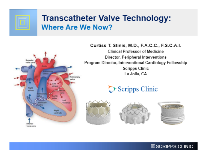 Transcatheter Valve Technology: Where Are We Now?
