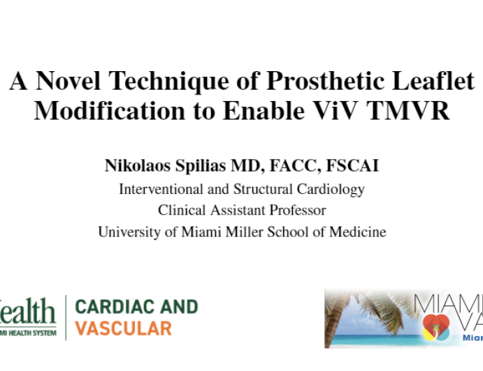 A Novel Technique of Prosthetic Leaflet Modification to Enable ViV TMVR