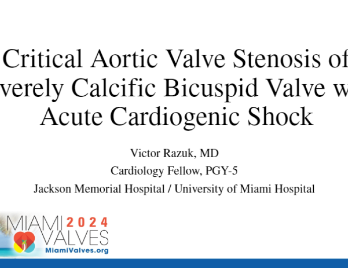 Critical Aortic Valve Stenosis of Severely Calcific Bicuspid Valve with Acute Cardiogenic Shock