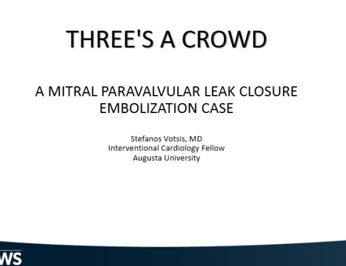 Three's A Crowd: A Mitral Paravalvular Leak Closure Embolization Case