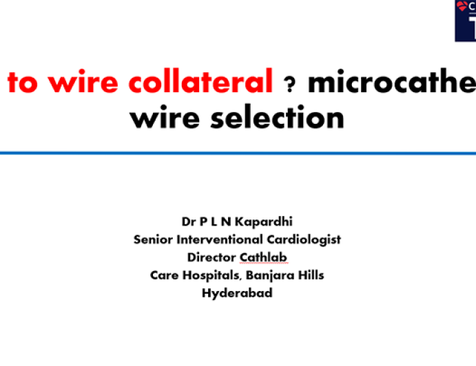 How to wire collateral? microcatheter & wire selection