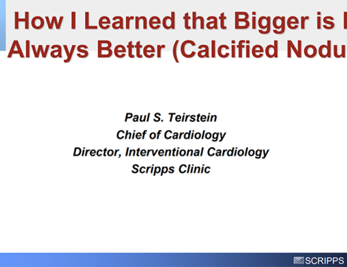 Calcified Nodules: How I Learned That Bigger is Not Always Better