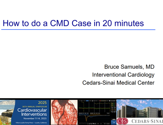 How to Do a Coronary Microvascular Disease Case in 20 Minutes