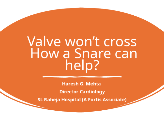 Valve won’t cross: How a Snare can help?