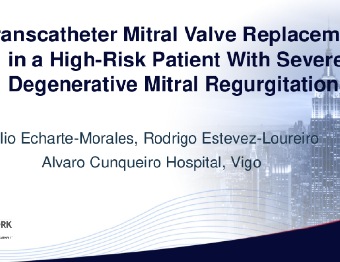 Transcatheter Mitral Valve Replacement in a High-Risk Patient With ...