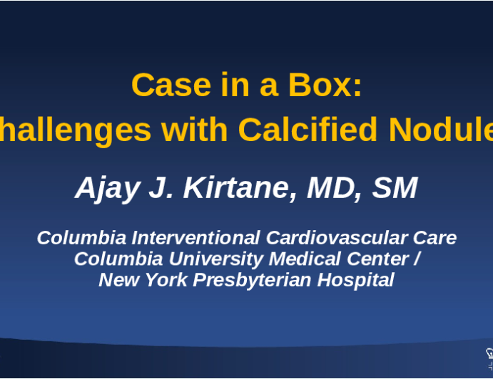 Case in a Box: Challenges with Calcified Nodules