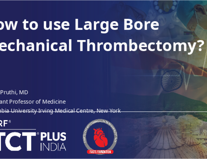 How to use Large Bore Mechanical Thrombectomy?
