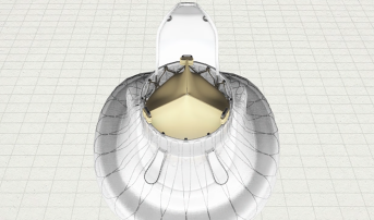 LuX-Valve TTVR Device Provides Favorable 1-Year Results