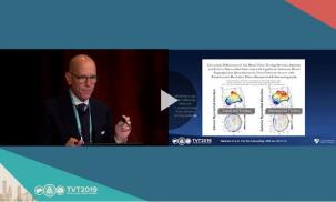 TMVR: Preparing For The Next Revolution 2019