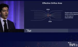 Aortic Stenosis, TAVR, ViV-TAVR: Peri-procedural Hemodynamics