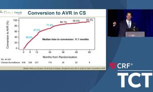 Treatment of Severe Aortic Stenosis: Why Wait for Symptoms? 