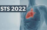 sts 2022